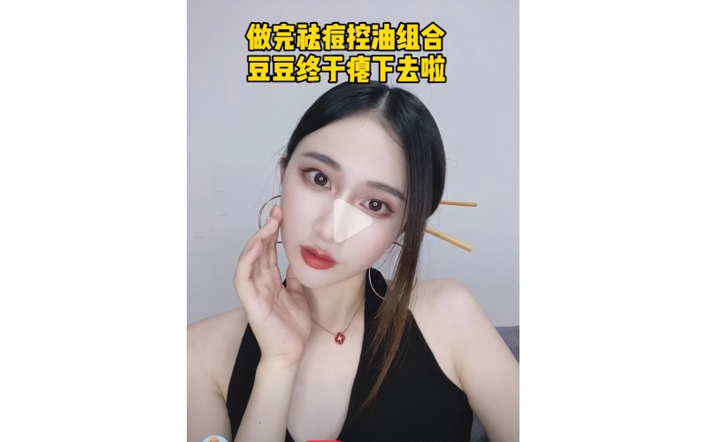 豆豆肌有(yǒu)救啦｜伊膚泉控油祛痘微針yyds